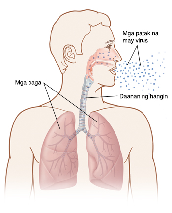 Balangkas ng ulo at dibdib ng tao na nakabaling ang ulo sa gilid. Nakikita ang loob ng ilong, daanan ng hangin, at mga baga. Nalalanghap patungo sa ilong at baga ang mga patak ng virus.