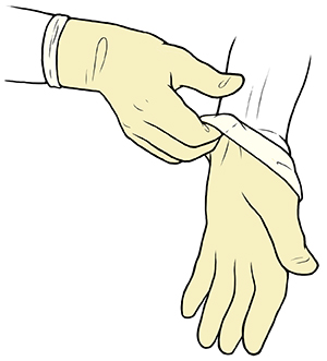 Gloved hand pulling sterile glove up to wrist of opposite hand.