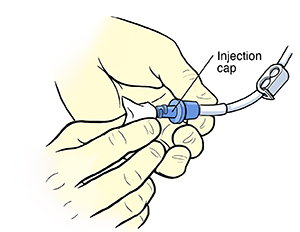 Closeup of gloved hands cleaning injection cap of central line with alcohol wipe.