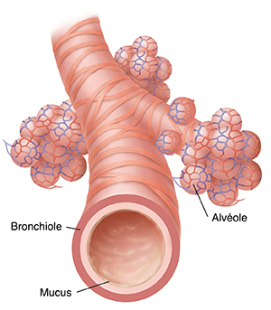 Gros plan d'un des bronchioles et des alvéoles.